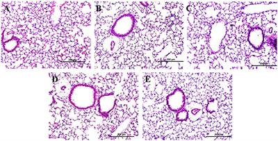 Exposure to Silver Nanospheres Leads to Altered Respiratory Mechanics and Delayed Immune Response in an in Vivo Murine Model